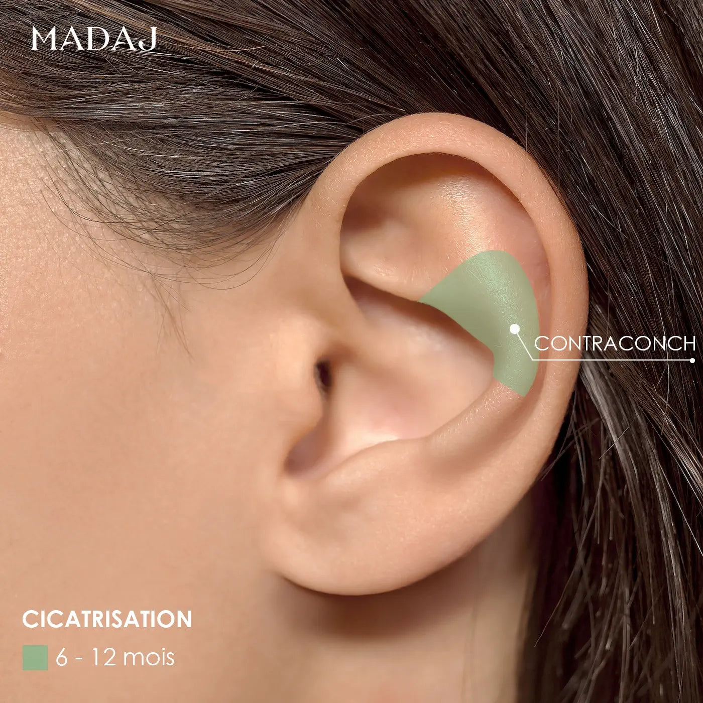 Temps de Cicatrisation du Piercing Contraconch