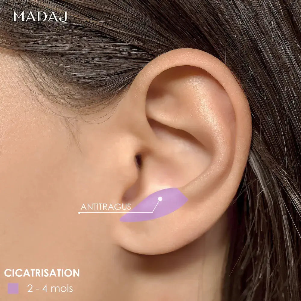 Temps cicatrisation antitragus piercing